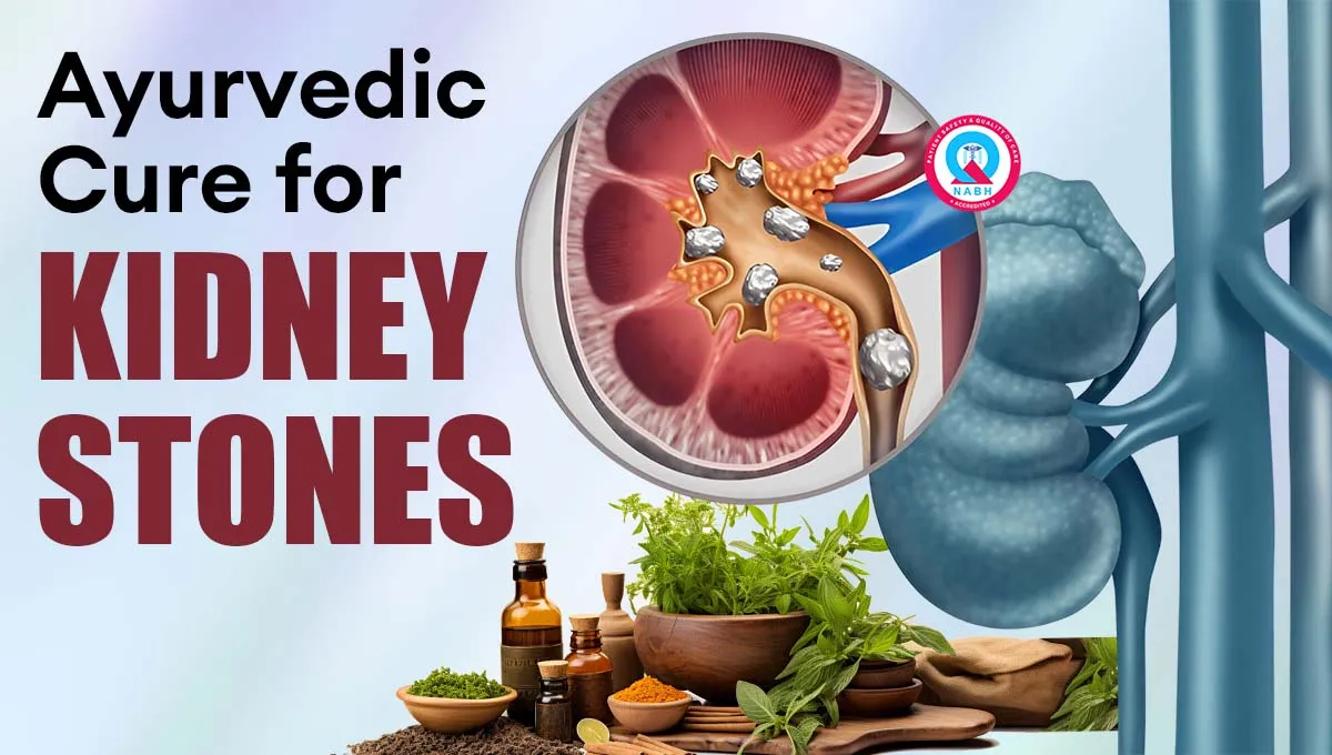 ayurvedic-cure-for-kidney-stones